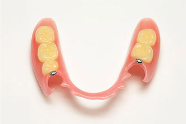 ノンクラスプデンチャー(自費診療)